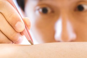 【もしも】全身の毛穴が蟻の巣になったら。ホラーしかない。
